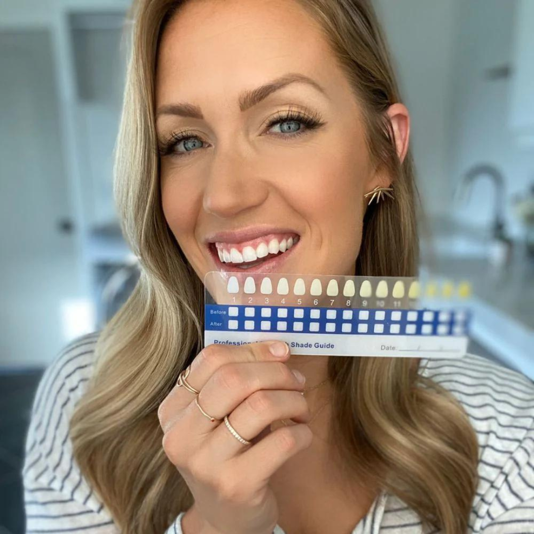 ArcticGlo Teeth Whitening Kit